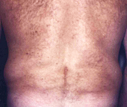 Patient # 19638 Before Photo # 5