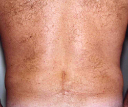 Patient # 19638 After Photo # 6